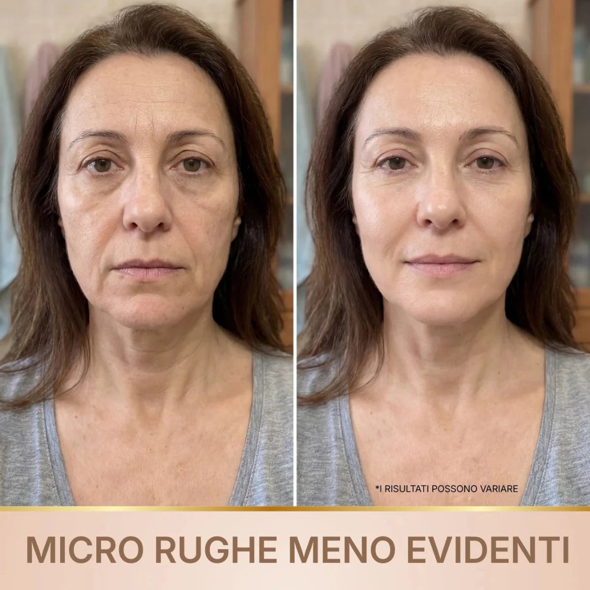 VareLift™ - Koreanisches Lifting-Serum mit Effekt ab der ersten Anwendung - Varelax™